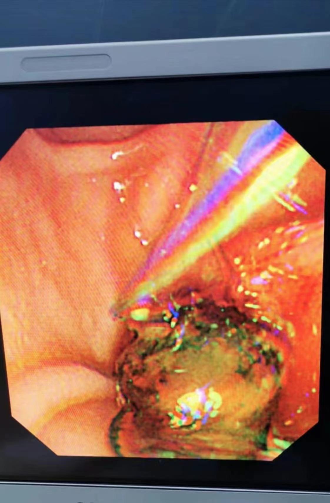 ccaa90e4-27f0-4712-95d5-d8baa6e7f6b6.jpg ccaa90e4-27f0-4712-95d5-d8baa6e7f6b6.jpg